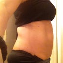 Two weeks before surgery