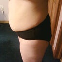 Before side