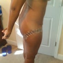 5 days after surgery