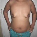 146 lbs. Day before the surgery