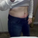 5 WEEKS POST OP: look at my definition in the middle! (redness from jeans on skin)