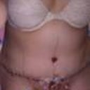 day aftr surgery