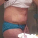 New side view.  I have a lot of swelling, but it's looking better!