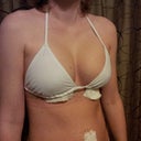 Boobs! With my bikini top I tried on before surgery (see above)