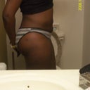 Side View 7 Wks Post Op