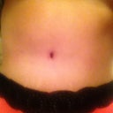 Same pic but looks swollen..13 days post op