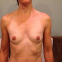 Pre-op