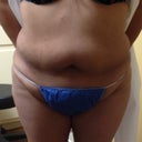 1st Photo taken by Doctor Front