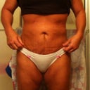 March 6, 2 and 1/2 months.  Still getting better , I hope.