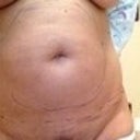 Doctor's office before procedure.