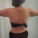 Photo1: My arms before vaser. From this photo please notice my waist (i had more curve before) i feel like i have a tumor under my waist. The photo didn't clear but i know that the fat tumor is gone.