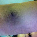 after 4 weeks