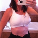 2 Days Post Op