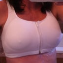 2 Days Post Op