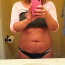 Before: front view