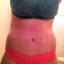 17 DPO. I don't feel as fat/thick from this angle lol :) and my incision is hidden nicely. Also, if MTV ever does a "True Life: I'm Obsessed with my Belly Button," be sure to look out for yours truly...how cute is it?!?!