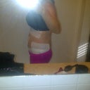 day 6 Post op.  I took this, this morning and I am happy its starting to look great!!!!