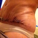 Dense and bluffs on my left side