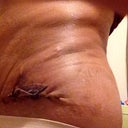 The close up