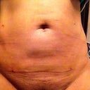 4th day. Can you tell the difference?