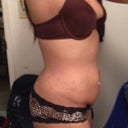 Side view