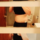 1 week post-op. Very swollen, looks like I've gained weight! But I know it will go down and I'll start seeing some awesome results soon :)