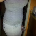 Side view at 11 days post-op/night