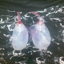 My drains the day of surgery