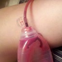 My drains on Sunday the 13th, 4 days post op