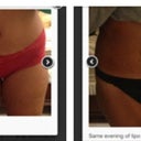 Pre-op (in red) post op I day (black)