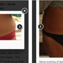 Pre-op and 1 day post op