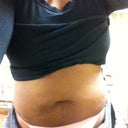 before tummy tuck