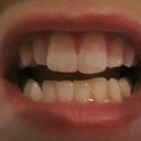 Before - Jan 17, 2013