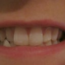 Before - Jan 17, 2013
