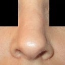 I hate how bulky and asymmetircal my nose looks!