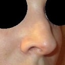 You can really see the split between my nasal bones here.