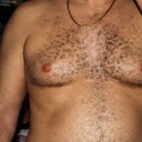 Before surgery