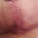 healing.... yay