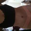 15 Days after surgery.