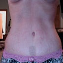 3 weeks (21 days po)