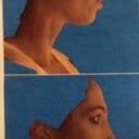 the 3D before and after image. ive asked to make my nose even smaller so we shall see.