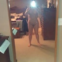 2 weeks 2 days postop