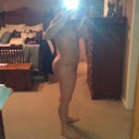 2 weeks 2 days postop