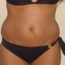 front before