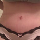 10 days post op..closer look. Swollen still but no hang!! Yeah