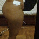 5 weeks post-op.