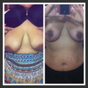Before and After