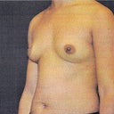 small (barely) 34B BEFORE the augmentation