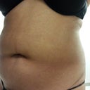 Front tummy view 3-8-13