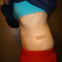 6 Days PO side view